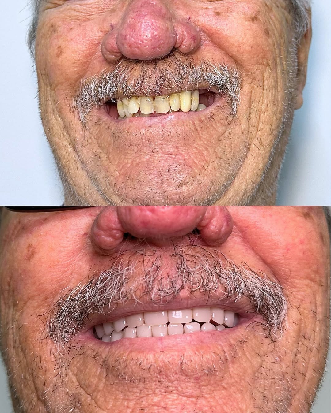 Antes e Depois — Caso 1